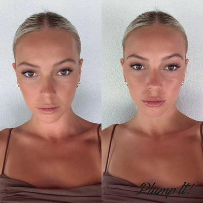 Repulpez-le ! Combleur Dermal Sans Aiguilles (30 applications)